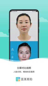 医美易拍