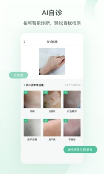 皮小宝